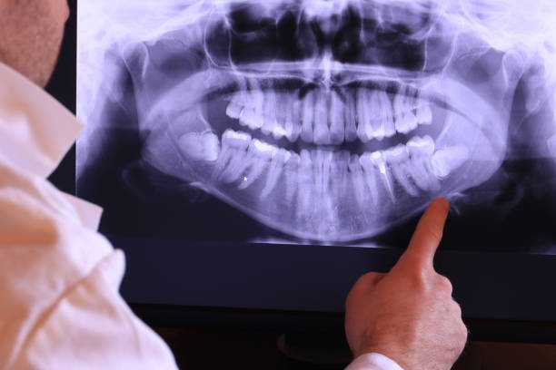 Best Weekend Emergency Dentist in Center Point, NM