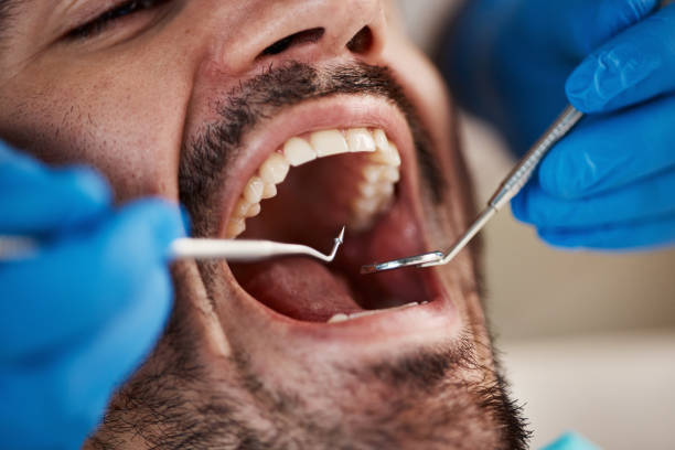 Best Cosmetic Emergency Dentistry in Center Point, NM