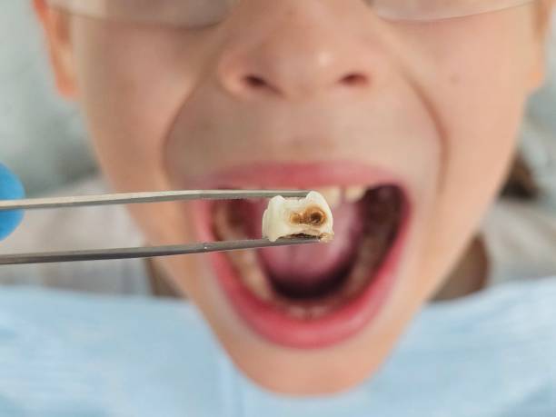 Best Pediatric Emergency Dentist in Center Point, NM