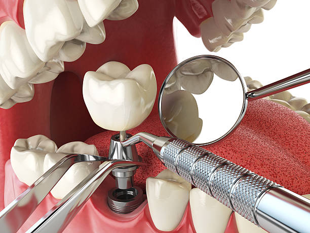 Best Emergency TMJ Treatment in Center Point, NM